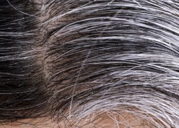 Hair Care TIPS: Get rid of white hair, easy home tips to follow