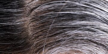 Hair Care TIPS: Get rid of white hair, easy home tips to follow