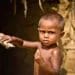 Increase in the number of malnourished children, UNICEF issued an alert