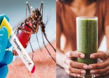 Dengue Home Remedies