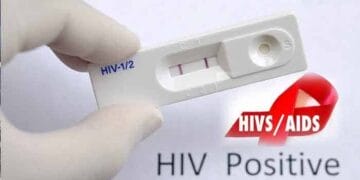 Hazaribagh HIV Positive