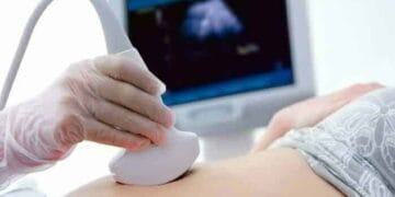 ultrasound