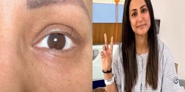 Actress Hina Khan, who is battling cancer, has only one eyelid left in her eyes, shared an emotional post