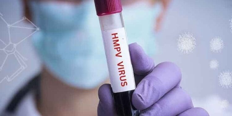 ranchi rims hmpv virus test kit